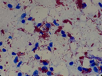 เชื้อ Mycobacterium leprae